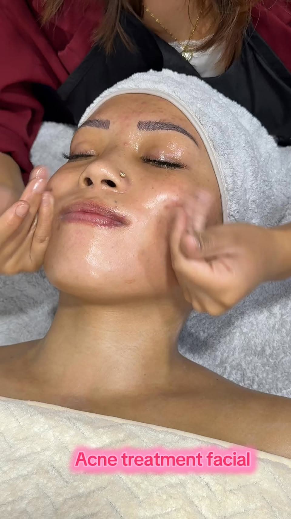 Hydra facial treatment Kathmandu Nepal